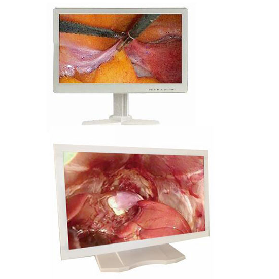 24 inches led Medical monitor patient display screen for surgery and Examination